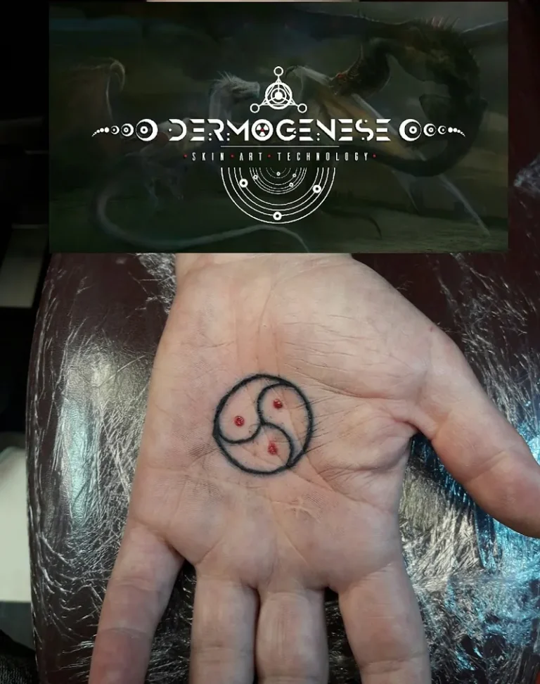 Dermogenese Tatto 7 768x972